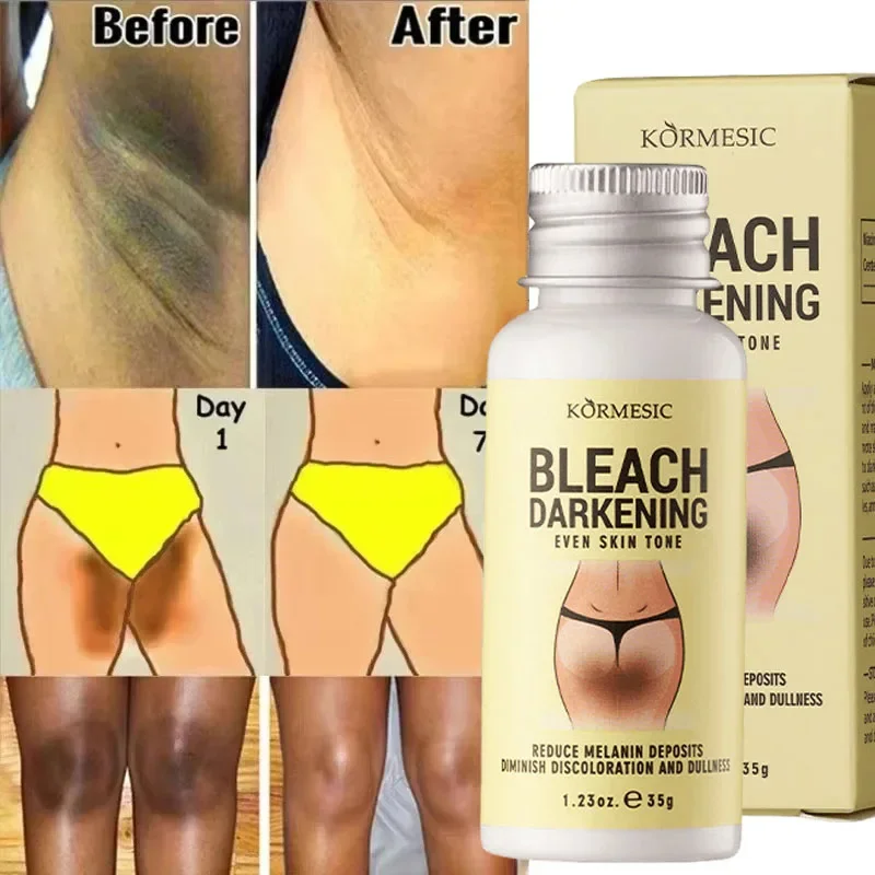 Body Whitening Cream Private Parts Underarm Bleaching Serum Whiten Butt Knee Brighten Inner Thigh Intimate Dark Remove Melanin - Image 3