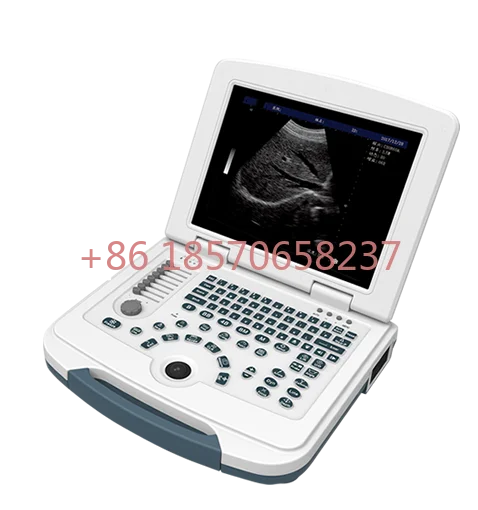 

color ultrasonic diagnostic system ultrasound therapy machines ultrasound machine price