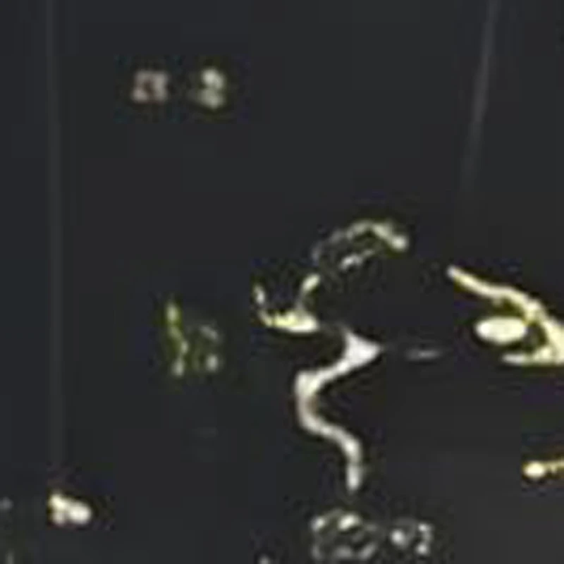 

Ear Wax Pliers Pick Tongs Earwax Remover Micro Alligator Crocodile Forceps Earpick Nose Operational Cleaner Clip Tweezer Tool C3