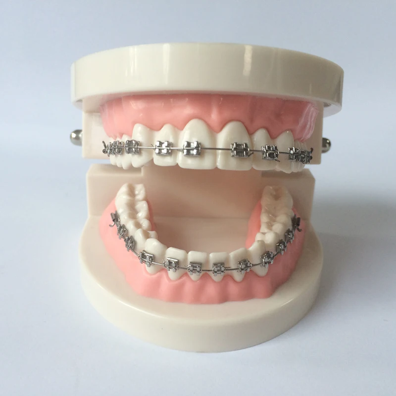 Dental Orthodontic Model With Brackets/Dental Teeth Model With Lingual Buttons/Orthodontic Teeth Model  Orthodontic Buccal Tubes