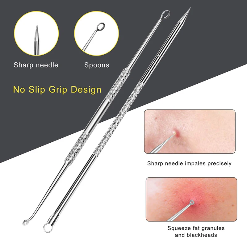 Mee-eter verwijderaar 10 stuks Professioneel puistje Comedo Extractor Tool Acne Removal Kit - Behandeling voor puistjes, mee-eters, Z