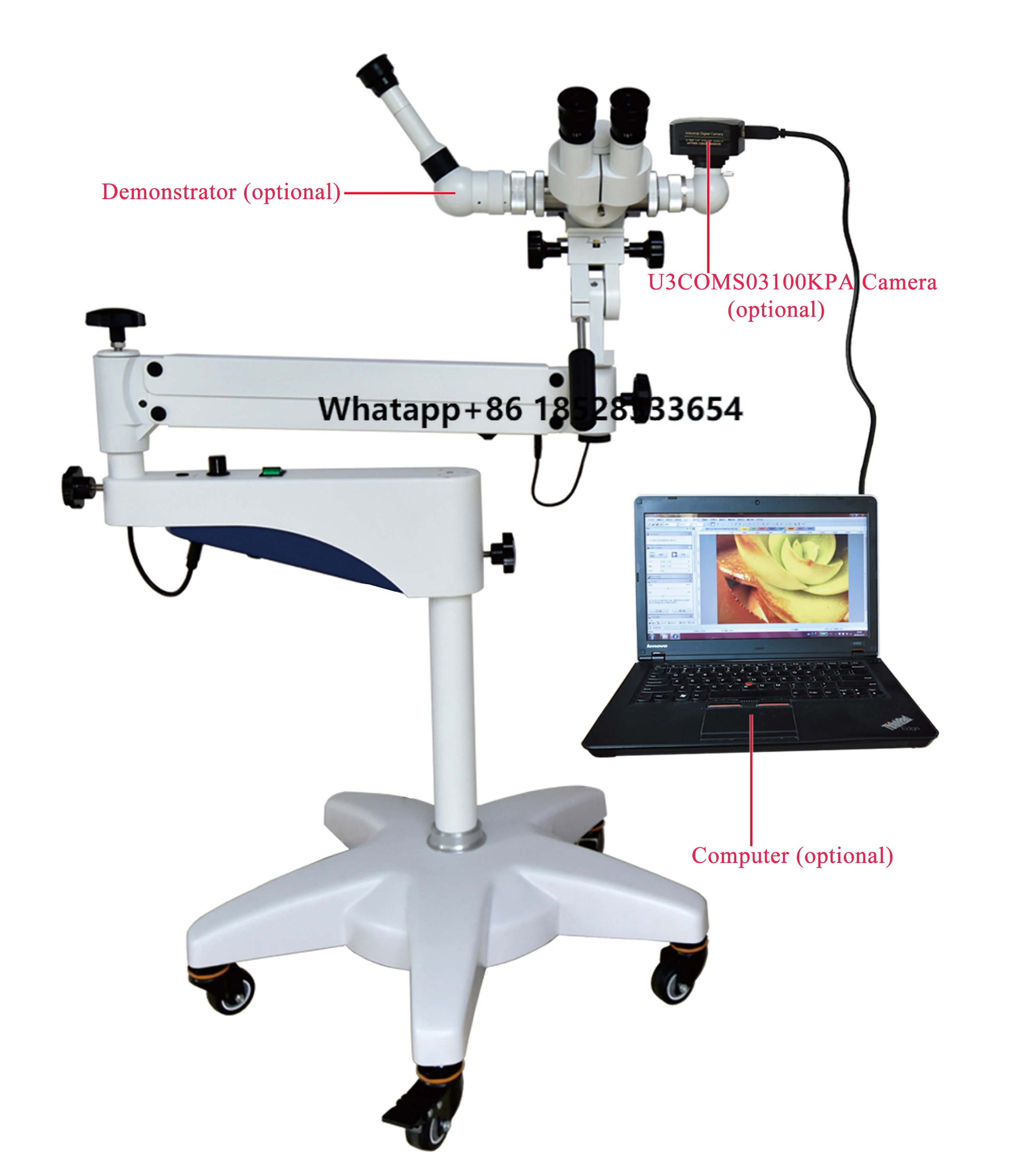 High Precision Portable Movable Digital HD Gynecological Video Colposcopy Microscope