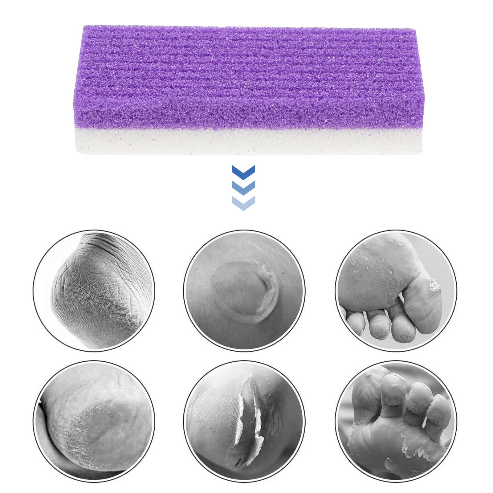 

4Pcs PU Foot Callus Remover Pedicure Scraper Rasp Exfoliator Smooth Feet Dry Cracked Heels Solution