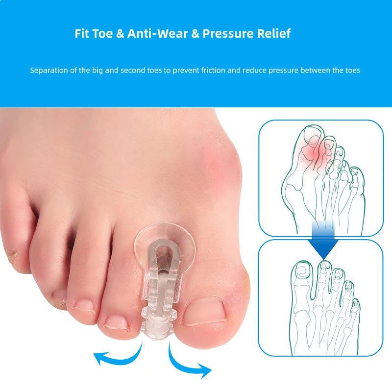 2pieces=1pair Toe Orthosis Clip Pads Big Foot Bone Care Tools Splitter Thumb Hallux Valgus Bunion Corrector Overlap Separators