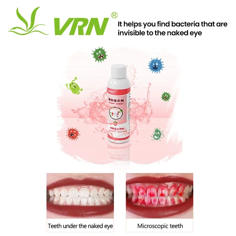 

VRN Plaque Display Agent Oral-Safe Colorants to Clearly Reveal Tartar Strawberry Extracts Care for Teeth Avoid Dental Problems