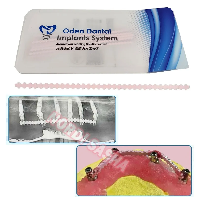 

10Pcs/Bag Dental All on 4 Metal Implant Supported Overdenture Bar Dental Implant Supported Overdenture Bar