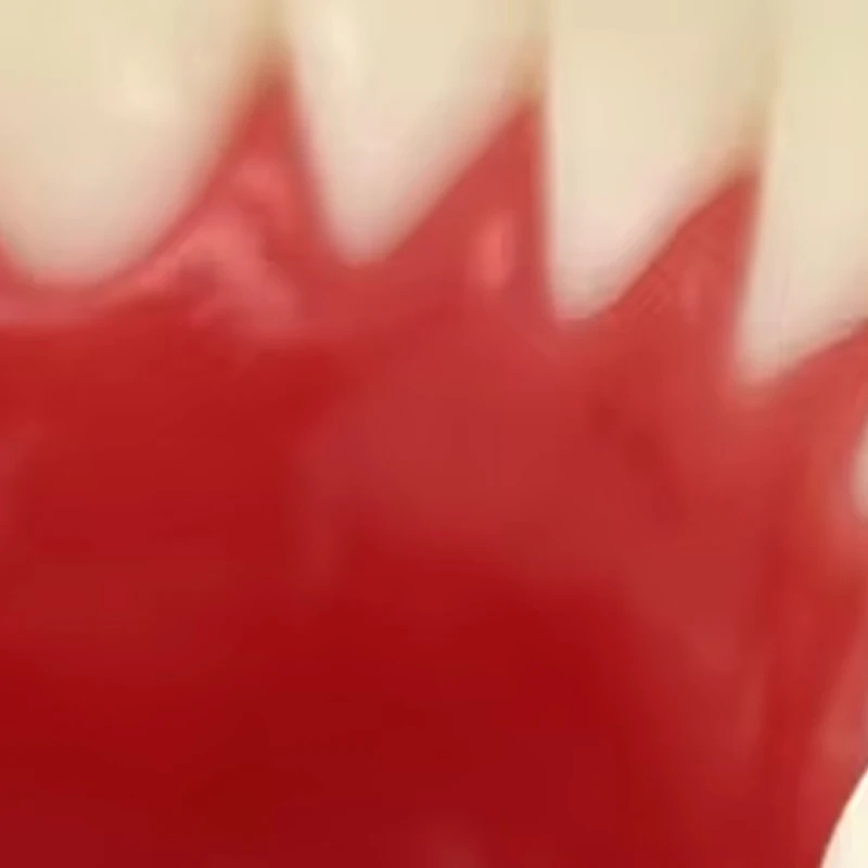 

2pcs Dental Matrix Holder Forceps Stainless Steel Clamp Band Tweezer for Sectional Matrix Placement Dental Instrument