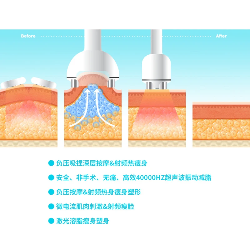 Machine de Perte de Poids Ultrasonique 5 en 1, Amincissante, 40K, Rafale de Graisse, Forme de Fusion, Infrarouge, Commerciale, Nouvelle Collection