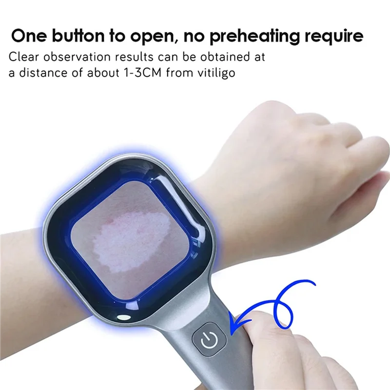 9月3日 ウッドランプ肌分析器 ポータブルフェイシャルサロン美容分析器 UVウッドランプ スキンケア分析検査用