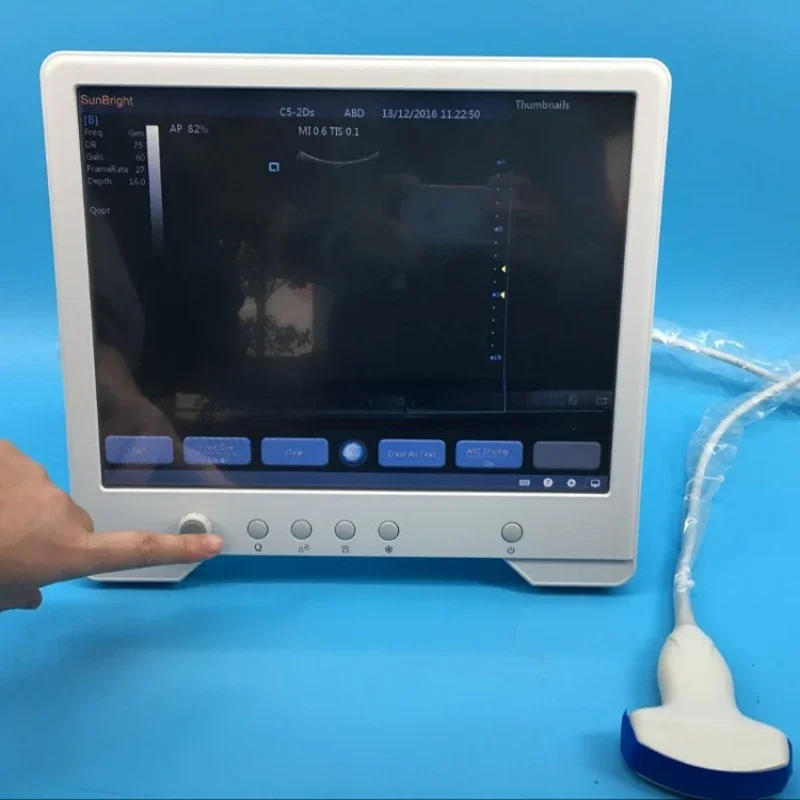 Clinic 15 inch LCD portable laptop touch screen ultrasound