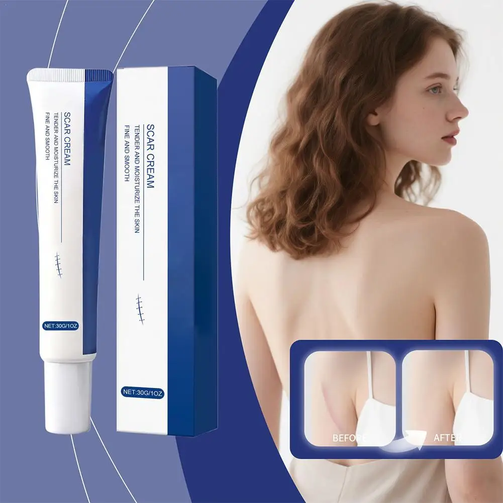

30g Scar Removal Cream Gel Remove Acne Spots Treatment Stretch Marks Burn Surgical Scar Repair Cream Smoothing Whitening Skin