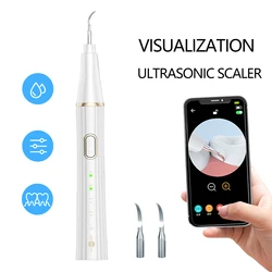 Ultrasonic Dental Scaler para Dentes Tartar Mancha, Removedor de Cálculo, Sonic Elétrico, Limpador De Placa, Aparelhos De Cuidados Pessoais