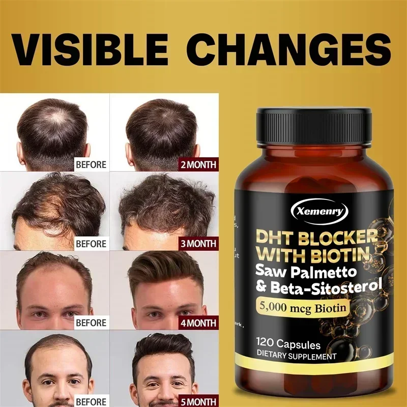 

Saw Palmetto Extract Capsules Prostate Health Supplement DHT Blocker Hair Growth for Mens Help Normal Urination Frequency Supple