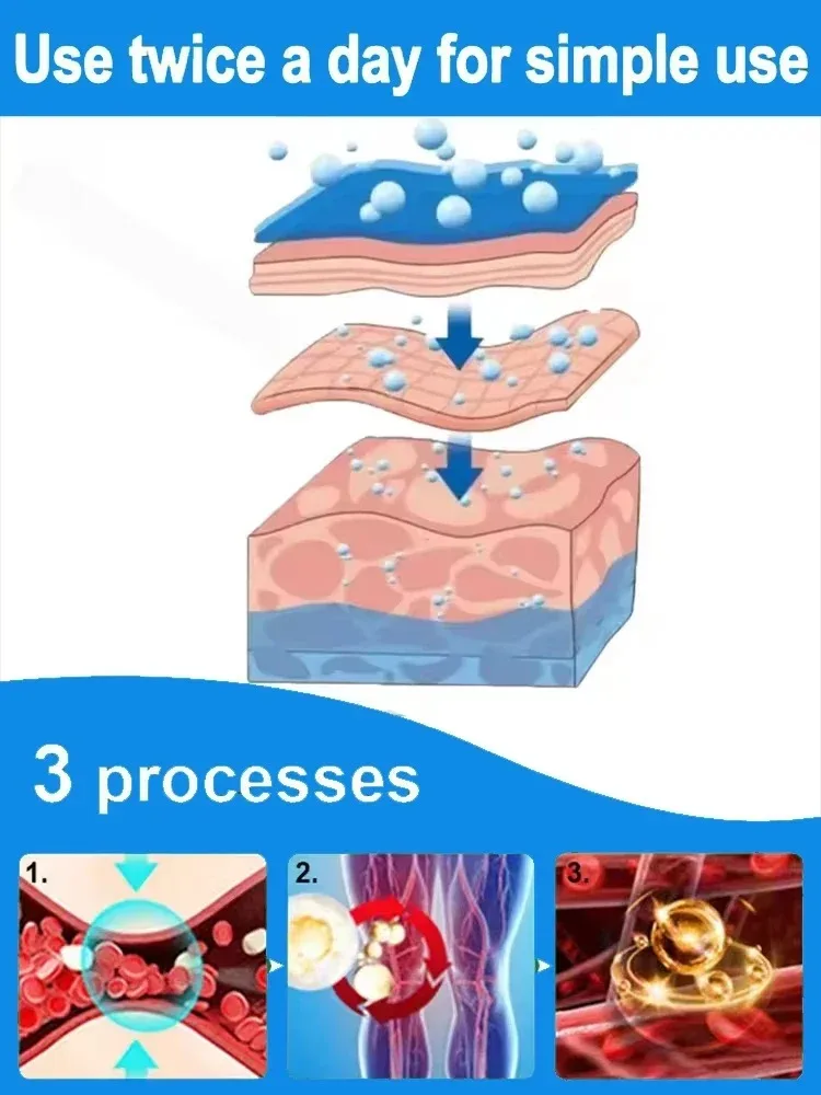 2025 Laser À Lumière Bleue | Améliore La Circulation Sanguine | Traitement Indolore Des Varices