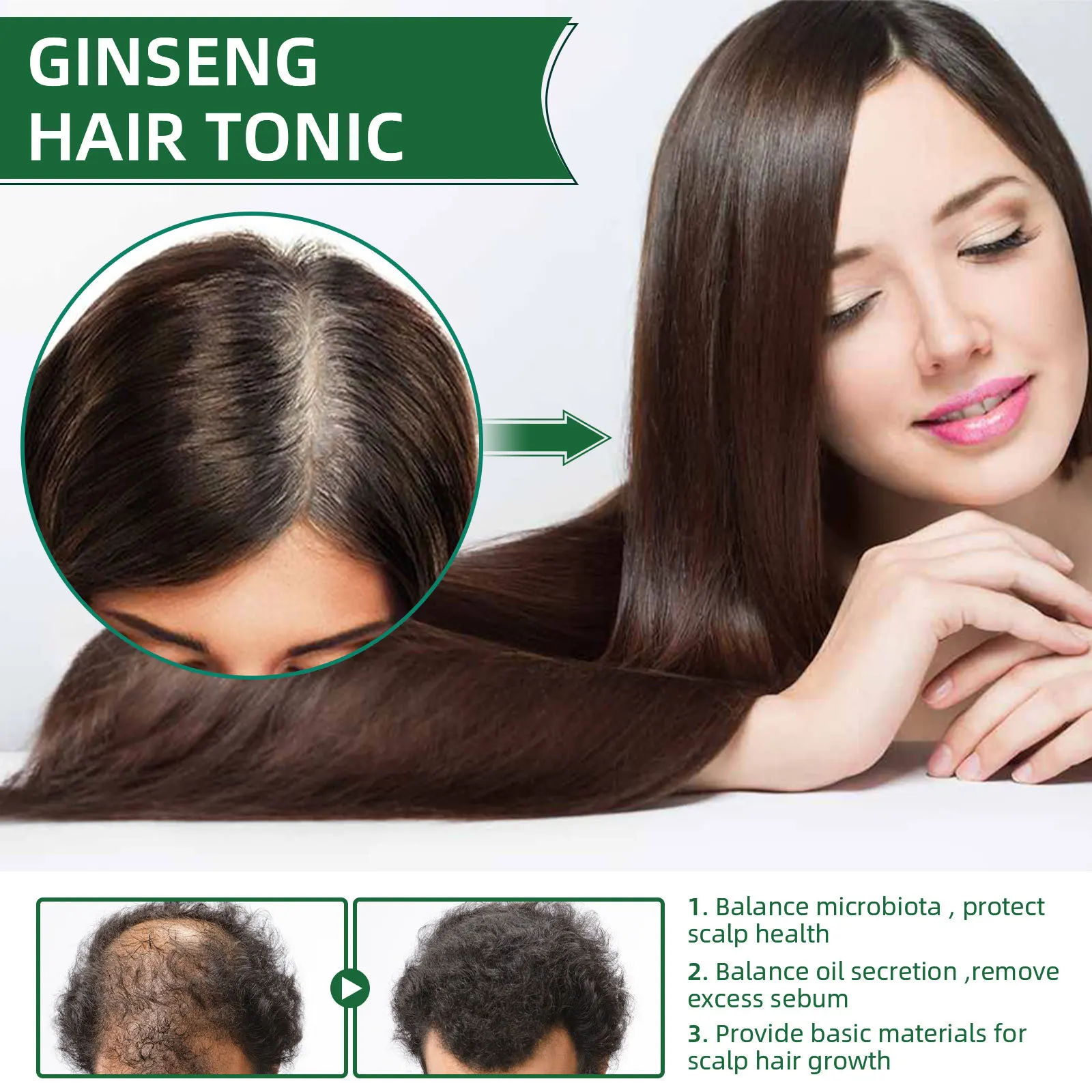 Hair Growth Serum Anti ป้องกันผมร่วงผมร่วง Liquid เสียซ่อมแซมผมเติบโตได้เร็วขึ้น100Ml