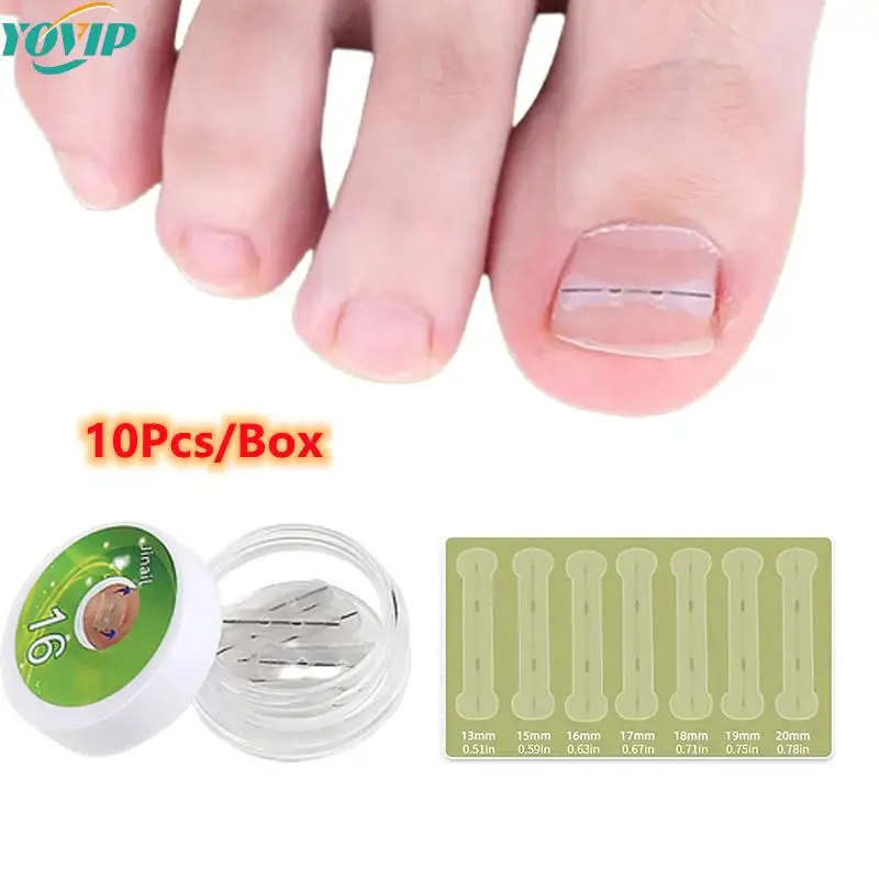 10 adet batık ayak tırnağı düzeltme aracı doğrultma klip Brace pedikür aracı batık ayak tırnak tedavisi elastik yama Sticker