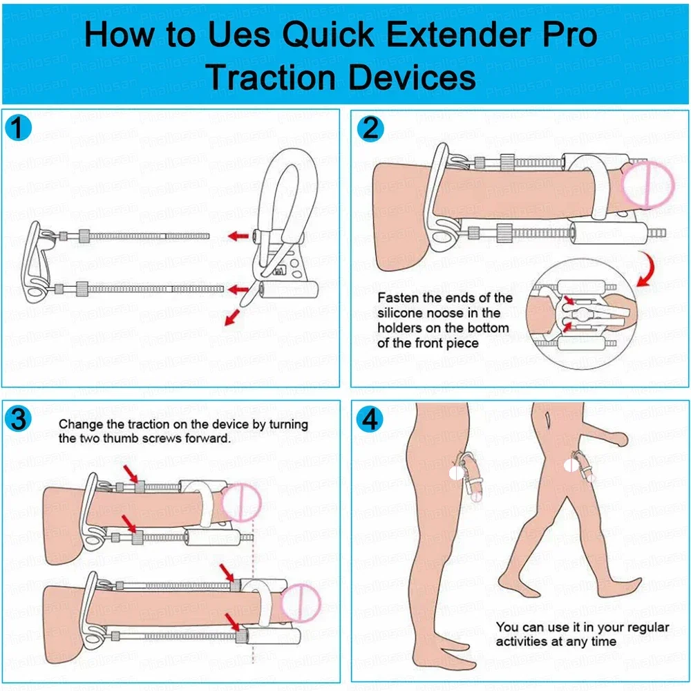 อุปกรณ์ขยายขนาดอวัยวะเพศชายสำหรับผู้ชายเครื่องขยายขนาดอวัยวะเพศชายรุ่น4th ช่วยแก้ไขแรงดึงและยืดขยายขนาดอวัยวะเพศชาย