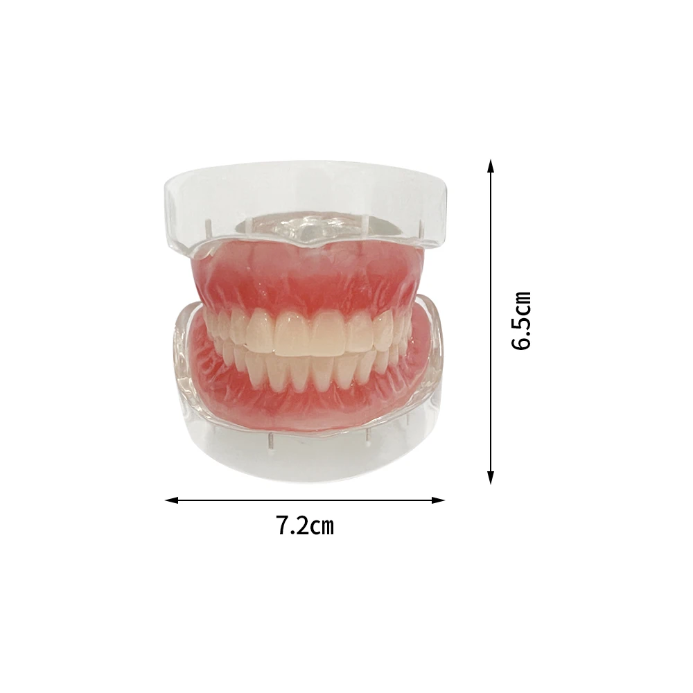 Modelo de implante Dental, producto de odontología, demostración de overdentadura Interior extraíble, mandíbula Superior e inferior con 4 implantes