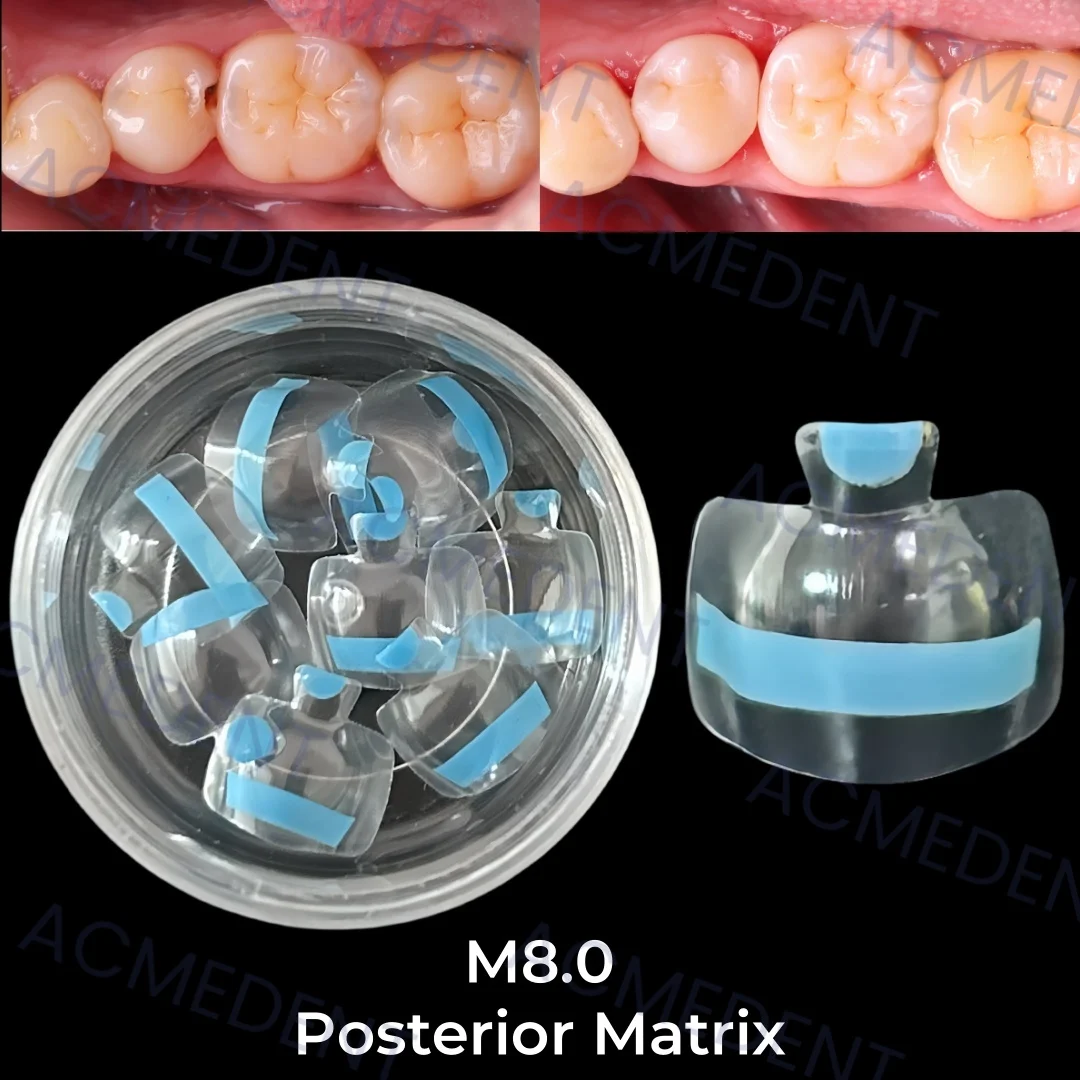 M8.0 Dental Transparent Clear Matrix Posterior Matrix BT Bow Maxillary Matrices Contoured Fit BioClear Matrice Black Triangle