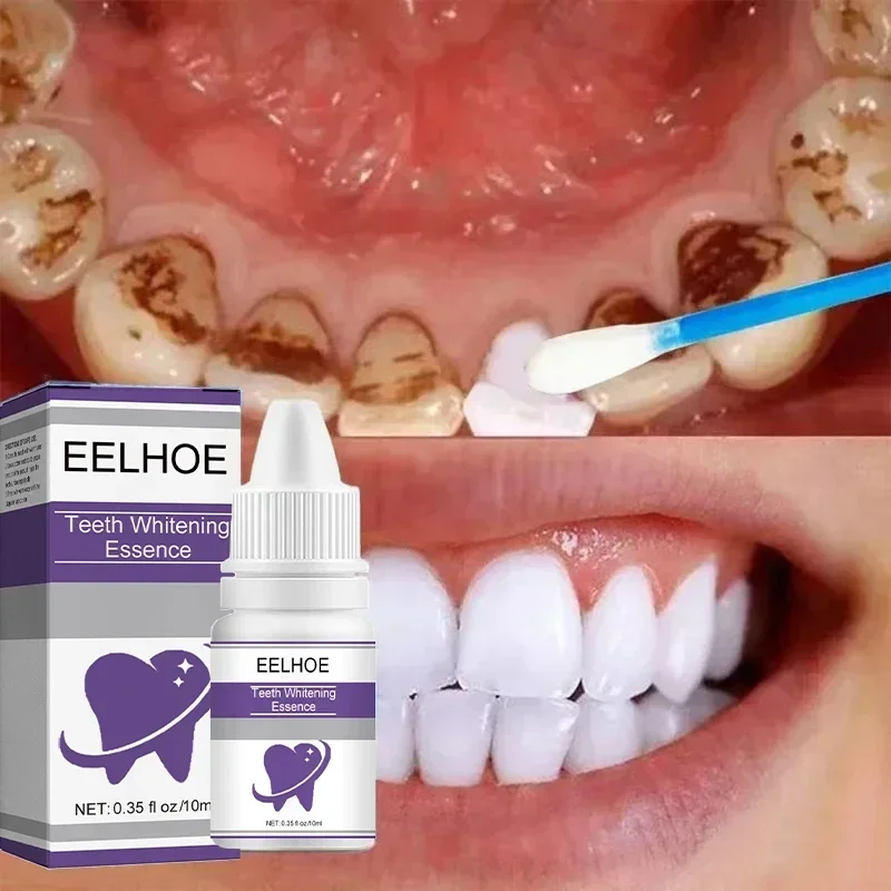 Esencia blanqueadora de dientes para limpieza, suero para eliminar la placa, suero para eliminar manchas de dientes amarillos, pasta de dientes de aliento fresco