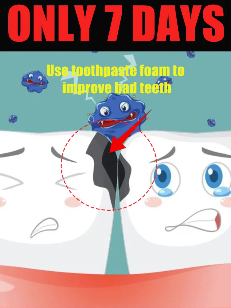 Intraoral Care Tools Lots of Foam Intraoral Mousse Solves Various Intraoral Problems