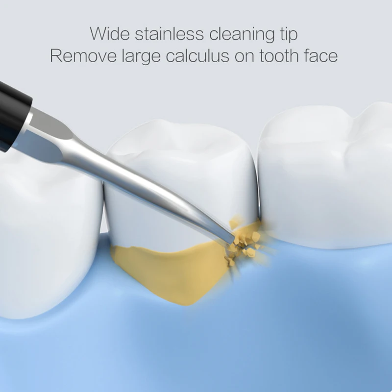 Xiaomi Youpin ymym dental cleaner profissional sonic dente calculus removedor ferramenta de remoção tártaro escova de dentes elétrica mais limpa