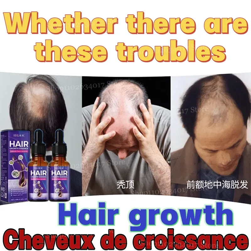 Reverse Hair Loss and Restore Your Confidence