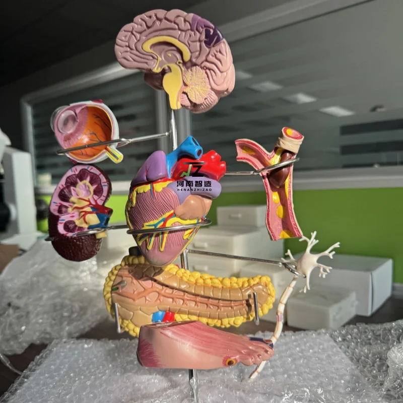 

High-Quality Diabetes Model, Medical Training and Teaching Model