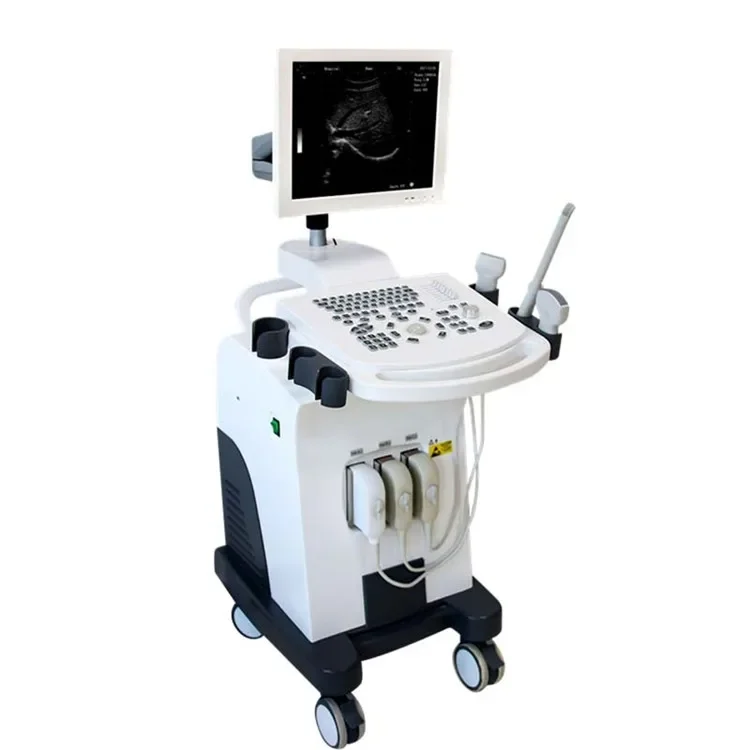 B/W ultrasound scanner ultrasound instrument trolley ultrasound machine FORERMED