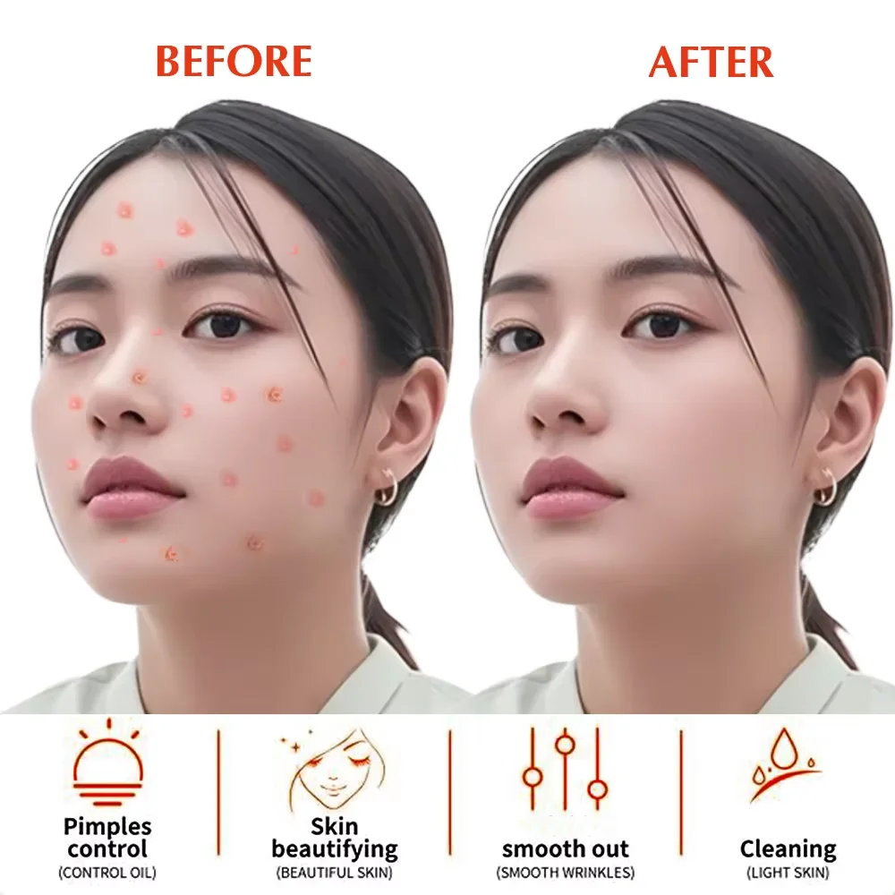 

Skin Wand Handheld High Frequency Skin Tightening Facial Wand Machine