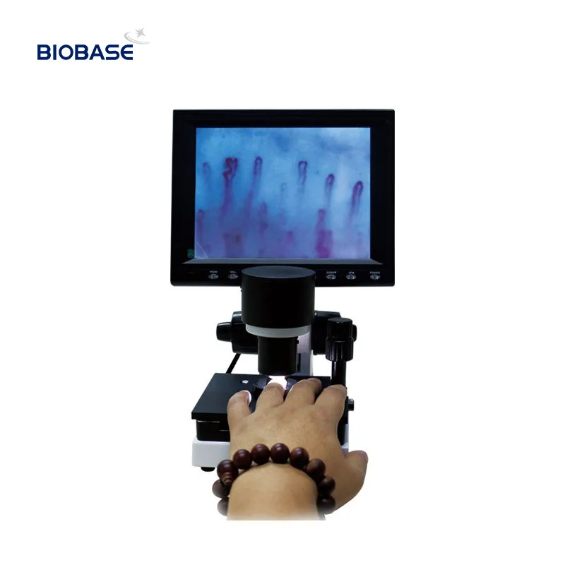 China Discount 380X-580X  Capillaroscope Detection  Capillary Biological Microcirculation Cpillary Microscope