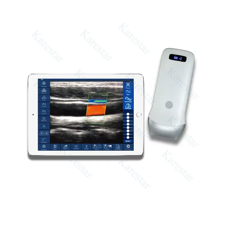 Vascular Linear Array Wireless Probe USB Wifi ultrasound Probe Easy to Carry ultrasound Scanner