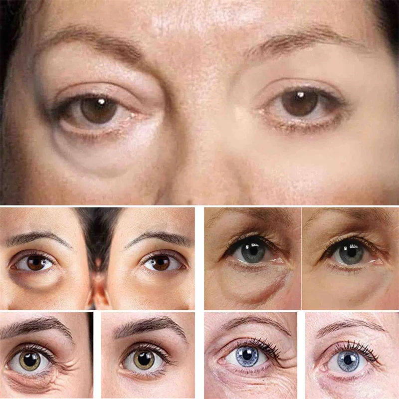 Crema per gli occhi al collagene di lumache Rassodante Linee sottili Riparazione Occhiaie Borse per gli occhi Gonfiore Pigmentazione Idratante Cura della pelle Bellezza