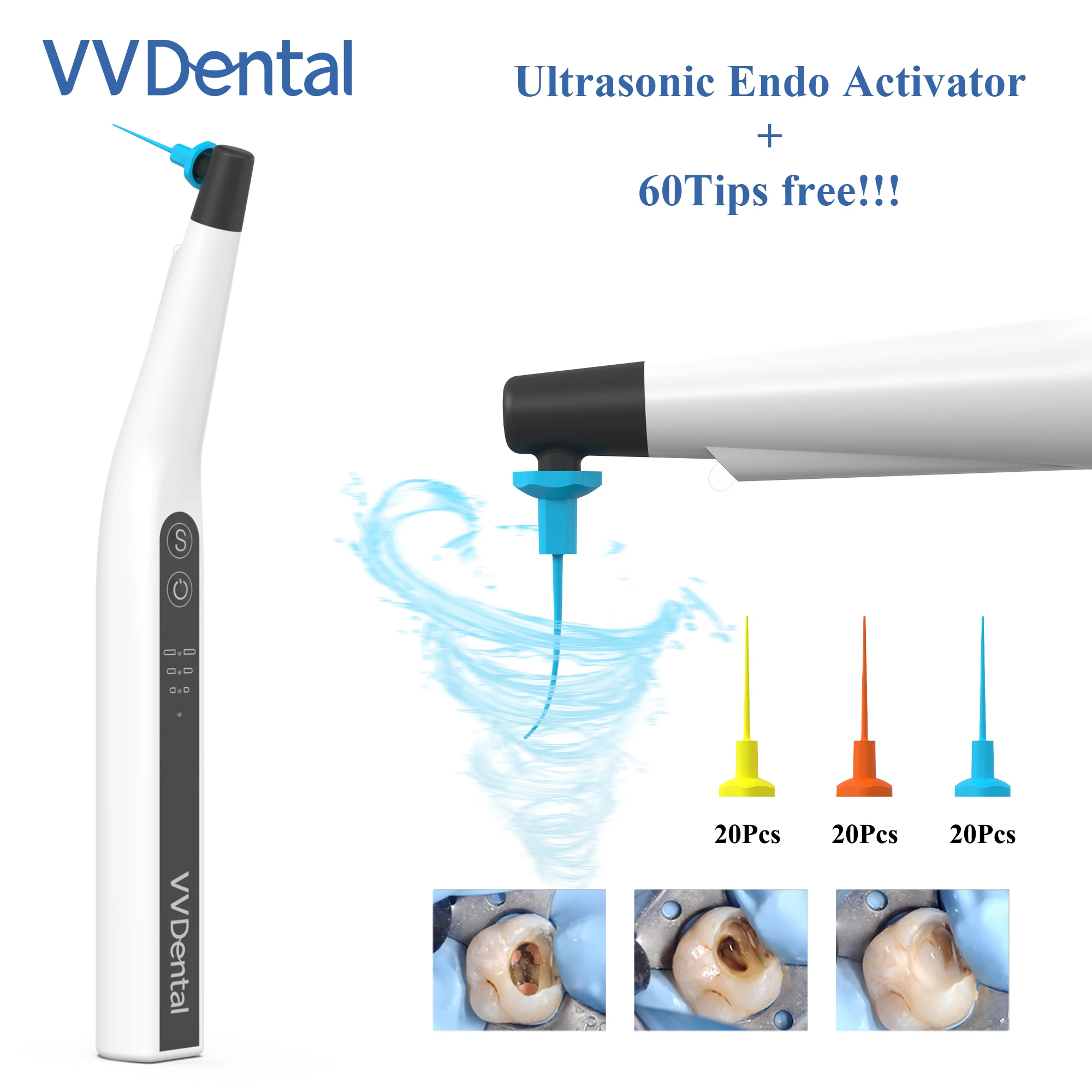 Sonic Endodontic Irrigator Endo Activator LED With 60 Pcs Tips Files Endodontics Cleaning Irrigating Dentistry Endoactivator