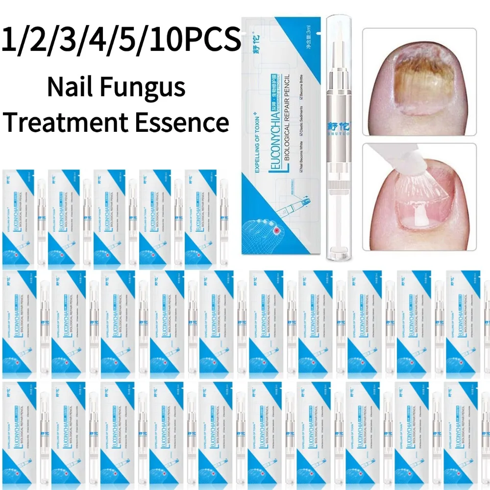 1/2/3/4/5/10PCS Nail Fungus Treatment Essence Serum Care Hand Gel Removal Fungus And Nail Anti-infective Repair Gel Care Foot