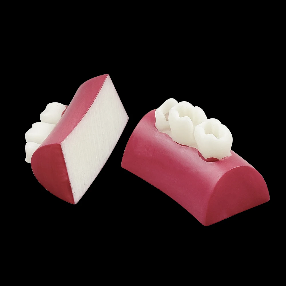 2pcs Dental Inlay Exercise Block Teeth Restoration Posterior Cavity Resin Filling Practice Model Root Canal Prep Simulator