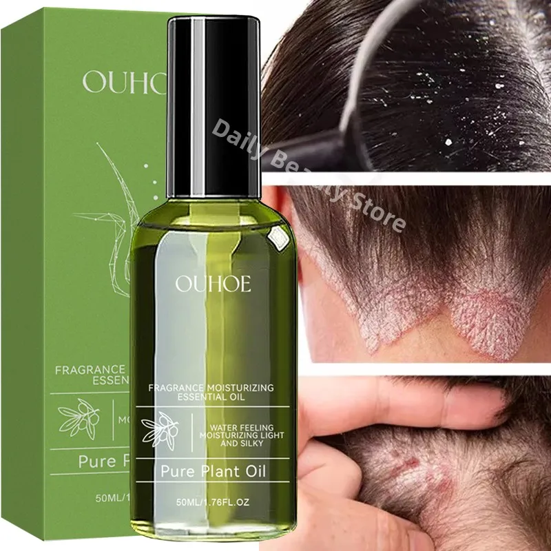 Эссенция Уход за волосами и кожей головы, спрей от перхоти, зуда, контроль жирности, антипотеря кожи головы, чистящая восстанавливающая сыворотка, товары для ухода за волосами