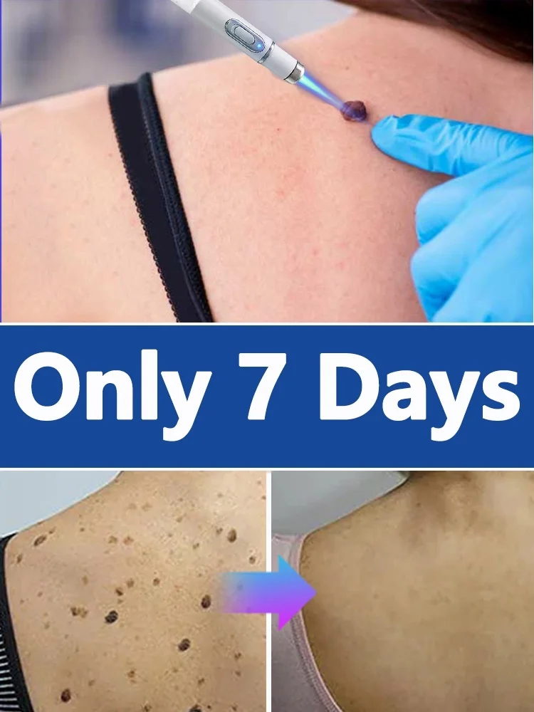 

Pʀᴏғᴇssɪᴏɴᴀʟ sᴏʟᴜᴛɪᴏɴ ᴛᴏ sᴋɪɴ ᴘʀᴏʙʟᴇᴍs