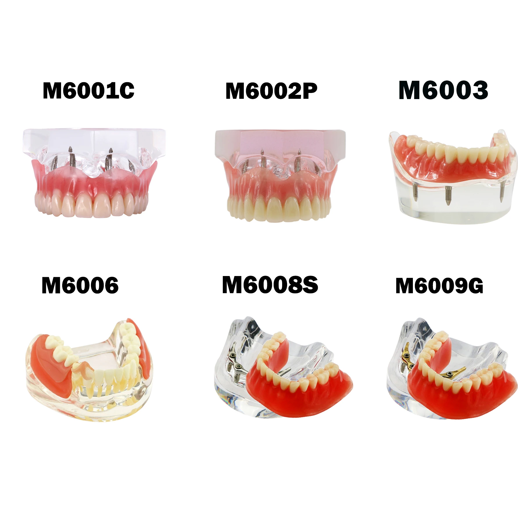 Dental teeth Model  Upper Lower Teeth Model with Removable Overdenture Dentist Patient Communication Demo Tooth Teaching Study