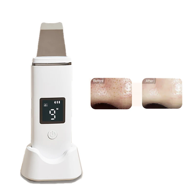 

STLF Face Cleaning Spatula Ultrasonic Scrubber Exfoliate Facial Dead Sonic Peeler Facial Scrubber