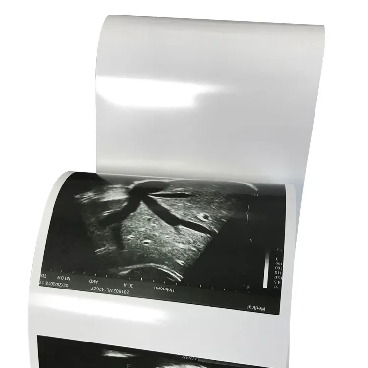 Imagem -05 - Ultrasound Printing Paper para Sony Preto e Branco Tamanho a6 Upp110hg Compatível