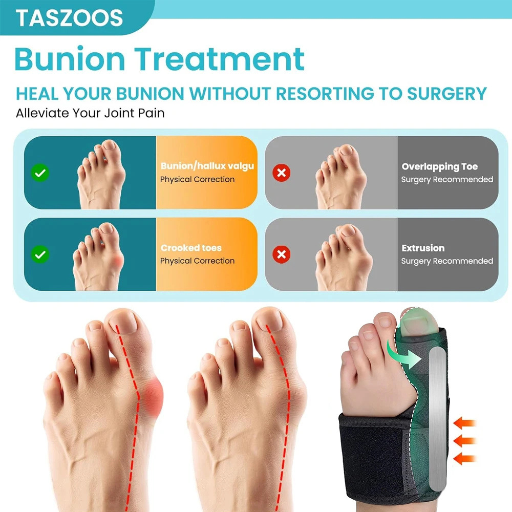  1/2 Stück Bunion Brace – Glätteisen mit großer Zehenkorrektur und Schiene – orthopädische Ärmel-Fußwickelunterstützung für Männer und Frauen – Detail 7