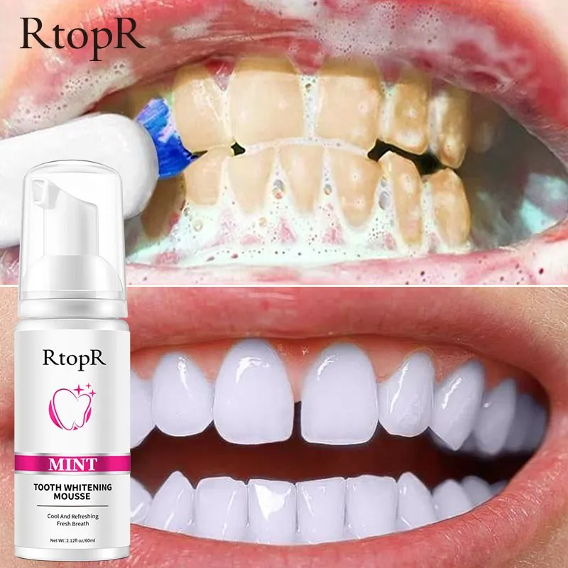 Mint Teeth Whitening Mousse Cleans The Mouth, Freshens The Breath, Cleans The Stains, Protects The Gums, Cleans The Teeth