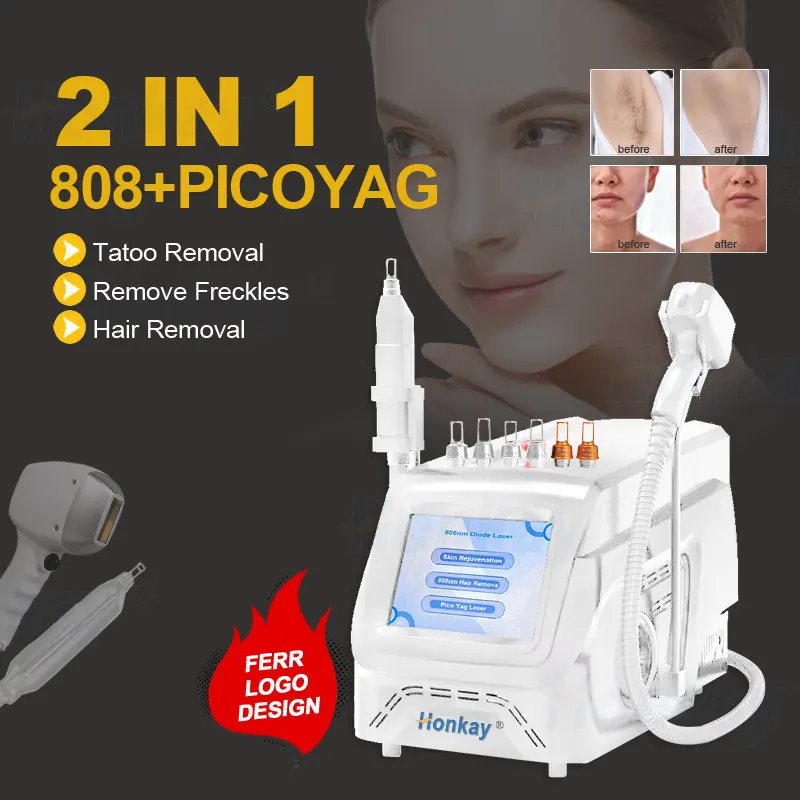 Laser For Hair Removal Nd Yag Laser Hair Removal Machine 755 808 1064 Diode Laser Hair Removal Machine