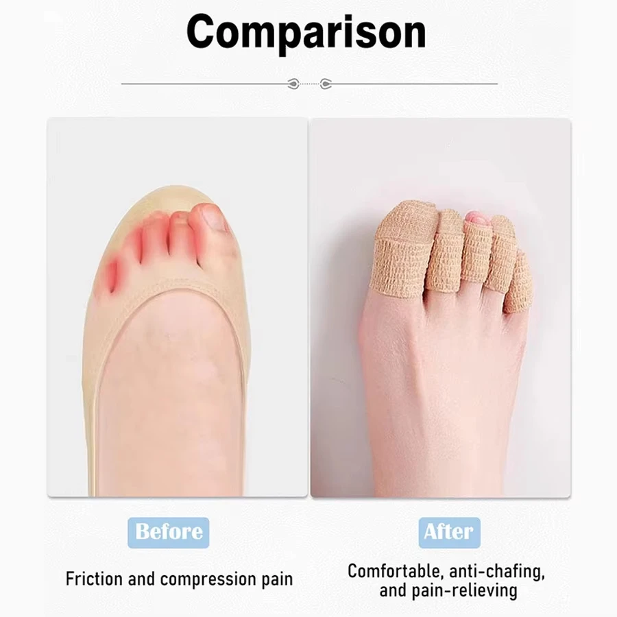 1/5/10 لفة واقيات مريحة لأصابع القدم - ضمادات مضادة للاحتكاك لحماية أصابع القدم والأصابع، تمنع الخشونة، للجنسين