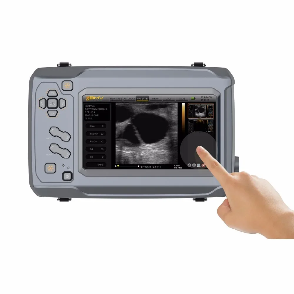 BestScan S6 Large Animals Veterinary Equipment Bovine Ultrasound Kaixin RKU10 Cattle Ultrasound Veterinary