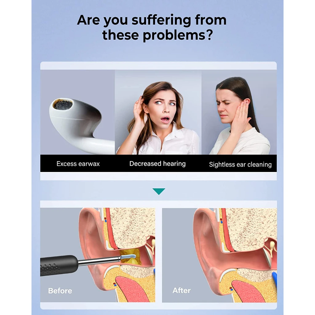 New Bebird Smart Visual Ear Sticker R1+ With Micro Camera 8 Million Pixels 6 LED Light For Home Ear Inspection Video Otoscope