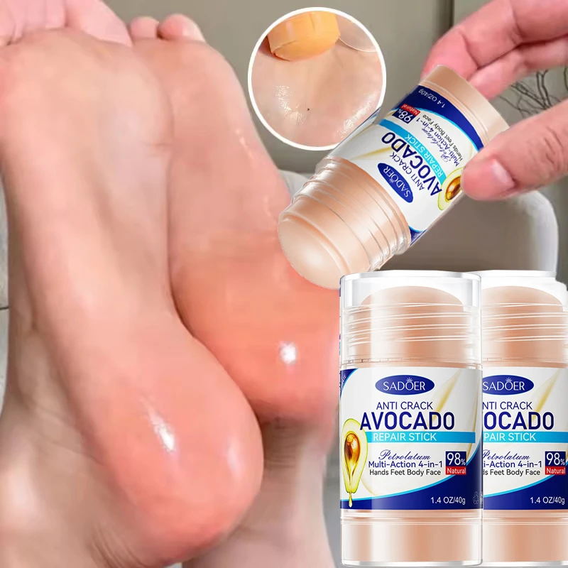

60% Urea Foot Cream Aloe Vera Ultra-hydrating Softening Dry Cracked Feet Cream Gentle Exfoliation Daily Foot Care Solution 40g
