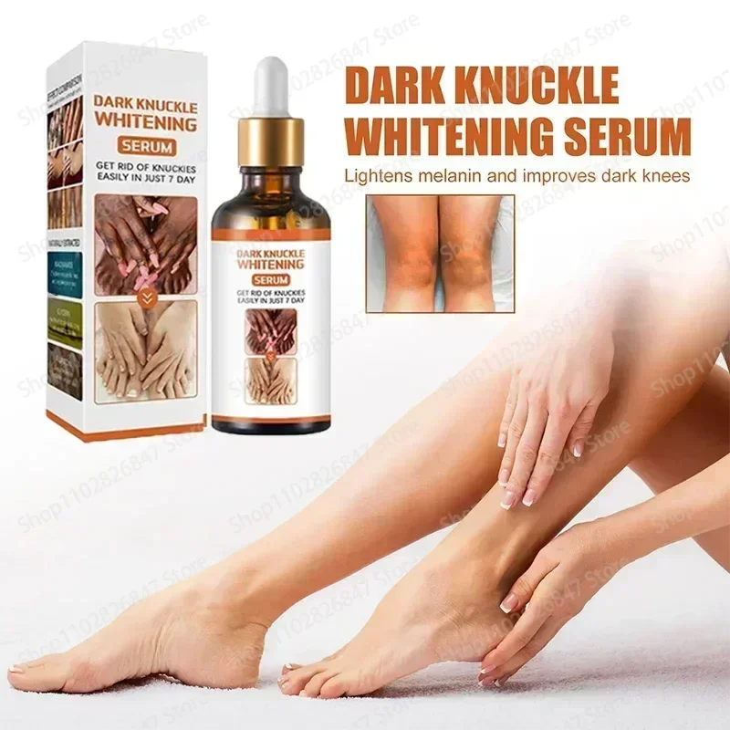 Knokkels Whitening Essence Voor Lip Areola 'S Private Delen Mals Verwijderen Intieme Melanine Huidverzorging Whitening Dark Spot Body Serum