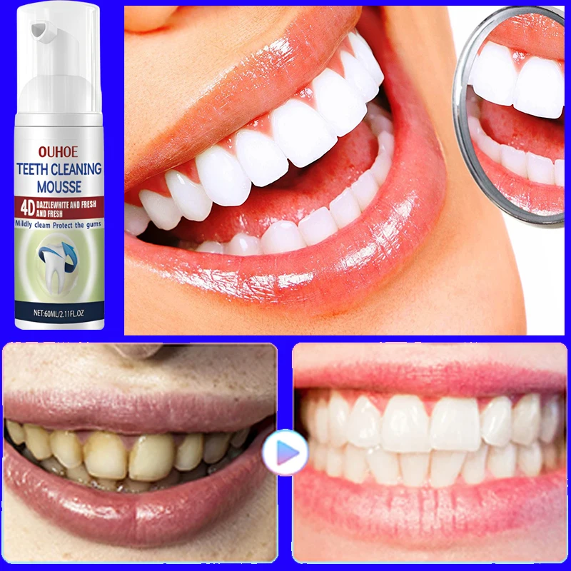 

Cleaning Teeth Toothpaste Fast Plaque Stains Yellow Fresh Breath Brighten